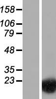 Western blot validation of overexpression lysate (Cat# LY422787) using anti-DDK antibody (Cat# TA50011-100). Left: Cell lysates from un-transfected HEK293T cells; Right: Cell lysates from HEK293T cells transfected with RC211827 using transfection reagent MegaTran 2.0 (Cat# TT210002).