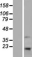 Western blot validation of overexpression lysate (Cat# LY413928) using anti-DDK antibody (Cat# TA50011-100). Left: Cell lysates from un-transfected HEK293T cells; Right: Cell lysates from HEK293T cells transfected with RC209408 using transfection reagent MegaTran 2.0 (Cat# TT210002).