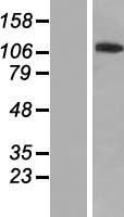 Western blot validation of overexpression lysate (Cat# LY405681) using anti-DDK antibody (Cat# TA50011-100). Left: Cell lysates from un-transfected HEK293T cells; Right: Cell lysates from HEK293T cells transfected with RC210915 using transfection reagent MegaTran 2.0 (Cat# TT210002).