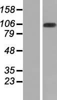 Western blot validation of overexpression lysate (Cat# LY407919) using anti-DDK antibody (Cat# TA50011-100). Left: Cell lysates from un-transfected HEK293T cells; Right: Cell lysates from HEK293T cells transfected with RC211279 using transfection reagent MegaTran 2.0 (Cat# TT210002).
