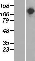 Western blot validation of overexpression lysate (Cat# LY406706) using anti-DDK antibody (Cat# TA50011-100). Left: Cell lysates from un-transfected HEK293T cells; Right: Cell lysates from HEK293T cells transfected with RC211018 using transfection reagent MegaTran 2.0 (Cat# TT210002).