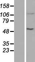 Western blot validation of overexpression lysate (Cat# LY410809) using anti-DDK antibody (Cat# TA50011-100). Left: Cell lysates from un-transfected HEK293T cells; Right: Cell lysates from HEK293T cells transfected with RC218001 using transfection reagent MegaTran 2.0 (Cat# TT210002).