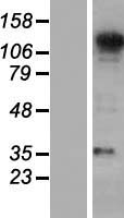 Western blot validation of overexpression lysate (Cat# LY421386) using anti-DDK antibody (Cat# TA50011-100). Left: Cell lysates from un-transfected HEK293T cells; Right: Cell lysates from HEK293T cells transfected with RC216802 using transfection reagent MegaTran 2.0 (Cat# TT210002).