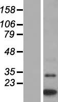 Western blot validation of overexpression lysate (Cat# LY415436) using anti-DDK antibody (Cat# TA50011-100). Left: Cell lysates from un-transfected HEK293T cells; Right: Cell lysates from HEK293T cells transfected with RC211540 using transfection reagent MegaTran 2.0 (Cat# TT210002).