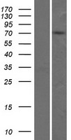 Western blot validation of overexpression lysate (Cat# LY407281) using anti-DDK antibody (Cat# TA50011-100). Left: Cell lysates from un-transfected HEK293T cells; Right: Cell lysates from HEK293T cells transfected with RC205451 using transfection reagent MegaTran 2.0 (Cat# TT210002).