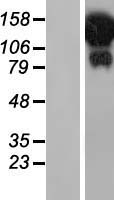 Western blot validation of overexpression lysate (Cat# LY414964) using anti-DDK antibody (Cat# TA50011-100). Left: Cell lysates from un-transfected HEK293T cells; Right: Cell lysates from HEK293T cells transfected with RC213643 using transfection reagent MegaTran 2.0 (Cat# TT210002).