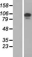 Western blot validation of overexpression lysate (Cat# LY415093) using anti-DDK antibody (Cat# TA50011-100). Left: Cell lysates from un-transfected HEK293T cells; Right: Cell lysates from HEK293T cells transfected with RC222211 using transfection reagent MegaTran 2.0 (Cat# TT210002).