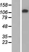 Western blot validation of overexpression lysate (Cat# LY422943) using anti-DDK antibody (Cat# TA50011-100). Left: Cell lysates from un-transfected HEK293T cells; Right: Cell lysates from HEK293T cells transfected with RC219544 using transfection reagent MegaTran 2.0 (Cat# TT210002).