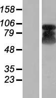 Western blot validation of overexpression lysate (Cat# LY412840) using anti-DDK antibody (Cat# TA50011-100). Left: Cell lysates from un-transfected HEK293T cells; Right: Cell lysates from HEK293T cells transfected with RC211986 using transfection reagent MegaTran 2.0 (Cat# TT210002).