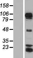 Western blot validation of overexpression lysate (Cat# LY407574) using anti-DDK antibody (Cat# TA50011-100). Left: Cell lysates from un-transfected HEK293T cells; Right: Cell lysates from HEK293T cells transfected with RC218676 using transfection reagent MegaTran 2.0 (Cat# TT210002).