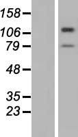 Western blot validation of overexpression lysate (Cat# LY405614) using anti-DDK antibody (Cat# TA50011-100). Left: Cell lysates from un-transfected HEK293T cells; Right: Cell lysates from HEK293T cells transfected with RC224266 using transfection reagent MegaTran 2.0 (Cat# TT210002).