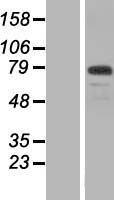 Western blot validation of overexpression lysate (Cat# LY407504) using anti-DDK antibody (Cat# TA50011-100). Left: Cell lysates from un-transfected HEK293T cells; Right: Cell lysates from HEK293T cells transfected with RC214887 using transfection reagent MegaTran 2.0 (Cat# TT210002).