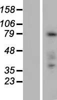 Western blot validation of overexpression lysate (Cat# LY405934) using anti-DDK antibody (Cat# TA50011-100). Left: Cell lysates from un-transfected HEK293T cells; Right: Cell lysates from HEK293T cells transfected with RC221152 using transfection reagent MegaTran 2.0 (Cat# TT210002).
