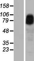 Western blot validation of overexpression lysate (Cat# LY414908) using anti-DDK antibody (Cat# TA50011-100). Left: Cell lysates from un-transfected HEK293T cells; Right: Cell lysates from HEK293T cells transfected with RC208320 using transfection reagent MegaTran 2.0 (Cat# TT210002).