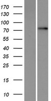 Western blot validation of overexpression lysate (Cat# LY419247) using anti-DDK antibody (Cat# TA50011-100). Left: Cell lysates from un-transfected HEK293T cells; Right: Cell lysates from HEK293T cells transfected with RC221238 using transfection reagent MegaTran 2.0 (Cat# TT210002).