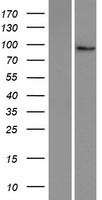 Western blot validation of overexpression lysate (Cat# LY428528) using anti-DDK antibody (Cat# TA50011-100). Left: Cell lysates from un-transfected HEK293T cells; Right: Cell lysates from HEK293T cells transfected with RC227354 using transfection reagent MegaTran 2.0 (Cat# TT210002).