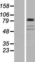 Western blot validation of overexpression lysate (Cat# LY404875) using anti-DDK antibody (Cat# TA50011-100). Left: Cell lysates from un-transfected HEK293T cells; Right: Cell lysates from HEK293T cells transfected with RC221308 using transfection reagent MegaTran 2.0 (Cat# TT210002).