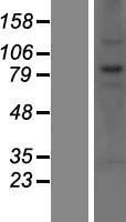 Western blot validation of overexpression lysate (Cat# LY414542) using anti-DDK antibody (Cat# TA50011-100). Left: Cell lysates from un-transfected HEK293T cells; Right: Cell lysates from HEK293T cells transfected with RC202651 using transfection reagent MegaTran 2.0 (Cat# TT210002).