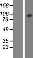 Western blot validation of overexpression lysate (Cat# LY410378) using anti-DDK antibody (Cat# TA50011-100). Left: Cell lysates from un-transfected HEK293T cells; Right: Cell lysates from HEK293T cells transfected with RC211028 using transfection reagent MegaTran 2.0 (Cat# TT210002).