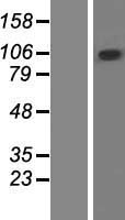 Western blot validation of overexpression lysate (Cat# LY414741) using anti-DDK antibody (Cat# TA50011-100). Left: Cell lysates from un-transfected HEK293T cells; Right: Cell lysates from HEK293T cells transfected with RC210911 using transfection reagent MegaTran 2.0 (Cat# TT210002).