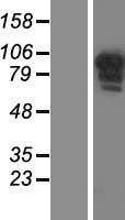 Western blot validation of overexpression lysate (Cat# LY405489) using anti-DDK antibody (Cat# TA50011-100). Left: Cell lysates from un-transfected HEK293T cells; Right: Cell lysates from HEK293T cells transfected with RC210946 using transfection reagent MegaTran 2.0 (Cat# TT210002).