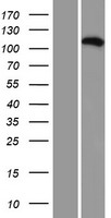 Western blot validation of overexpression lysate (Cat# LY412555) using anti-DDK antibody (Cat# TA50011-100). Left: Cell lysates from un-transfected HEK293T cells; Right: Cell lysates from HEK293T cells transfected with RC208420 using transfection reagent MegaTran 2.0 (Cat# TT210002).