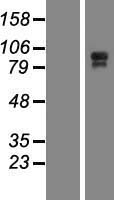 Western blot validation of overexpression lysate (Cat# LY411061) using anti-DDK antibody (Cat# TA50011-100). Left: Cell lysates from un-transfected HEK293T cells; Right: Cell lysates from HEK293T cells transfected with RC209786 using transfection reagent MegaTran 2.0 (Cat# TT210002).