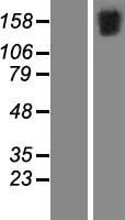 Western blot validation of overexpression lysate (Cat# LY410328) using anti-DDK antibody (Cat# TA50011-100). Left: Cell lysates from un-transfected HEK293T cells; Right: Cell lysates from HEK293T cells transfected with RC207450 using transfection reagent MegaTran 2.0 (Cat# TT210002).