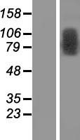 Western blot validation of overexpression lysate (Cat# LY410650) using anti-DDK antibody (Cat# TA50011-100). Left: Cell lysates from un-transfected HEK293T cells; Right: Cell lysates from HEK293T cells transfected with RC208439 using transfection reagent MegaTran 2.0 (Cat# TT210002).