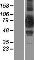 Western blot validation of overexpression lysate (Cat# LY418860) using anti-DDK antibody (Cat# TA50011-100). Left: Cell lysates from un-transfected HEK293T cells; Right: Cell lysates from HEK293T cells transfected with RC206350 using transfection reagent MegaTran 2.0 (Cat# TT210002).