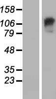Western blot validation of overexpression lysate (Cat# LY410236) using anti-DDK antibody (Cat# TA50011-100). Left: Cell lysates from un-transfected HEK293T cells; Right: Cell lysates from HEK293T cells transfected with RC205965 using transfection reagent MegaTran 2.0 (Cat# TT210002).