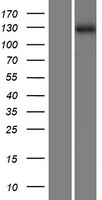 Western blot validation of overexpression lysate (Cat# LY411084) using anti-DDK antibody (Cat# TA50011-100). Left: Cell lysates from un-transfected HEK293T cells; Right: Cell lysates from HEK293T cells transfected with RC207242 using transfection reagent MegaTran 2.0 (Cat# TT210002).