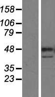 Western blot validation of overexpression lysate (Cat# LY407420) using anti-DDK antibody (Cat# TA50011-100). Left: Cell lysates from un-transfected HEK293T cells; Right: Cell lysates from HEK293T cells transfected with RC210988 using transfection reagent MegaTran 2.0 (Cat# TT210002).