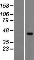 Western blot validation of overexpression lysate (Cat# LY404917) using anti-DDK antibody (Cat# TA50011-100). Left: Cell lysates from un-transfected HEK293T cells; Right: Cell lysates from HEK293T cells transfected with RC216656 using transfection reagent MegaTran 2.0 (Cat# TT210002).