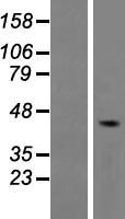 Western blot validation of overexpression lysate (Cat# LY404572) using anti-DDK antibody (Cat# TA50011-100). Left: Cell lysates from un-transfected HEK293T cells; Right: Cell lysates from HEK293T cells transfected with RC218409 using transfection reagent MegaTran 2.0 (Cat# TT210002).