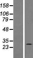 Western blot validation of overexpression lysate (Cat# LY422090) using anti-DDK antibody (Cat# TA50011-100). Left: Cell lysates from un-transfected HEK293T cells; Right: Cell lysates from HEK293T cells transfected with RC217725 using transfection reagent MegaTran 2.0 (Cat# TT210002).