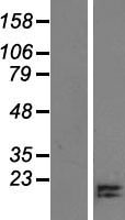 Western blot validation of overexpression lysate (Cat# LY423731) using anti-DDK antibody (Cat# TA50011-100). Left: Cell lysates from un-transfected HEK293T cells; Right: Cell lysates from HEK293T cells transfected with RC210017 using transfection reagent MegaTran 2.0 (Cat# TT210002).