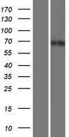 Western blot validation of overexpression lysate (Cat# LY414449) using anti-DDK antibody (Cat# TA50011-100). Left: Cell lysates from un-transfected HEK293T cells; Right: Cell lysates from HEK293T cells transfected with RC221686 using transfection reagent MegaTran 2.0 (Cat# TT210002).