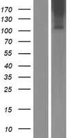 Western blot validation of overexpression lysate (Cat# LY406925) using anti-DDK antibody (Cat# TA50011-100). Left: Cell lysates from un-transfected HEK293T cells; Right: Cell lysates from HEK293T cells transfected with RC222706 using transfection reagent MegaTran 2.0 (Cat# TT210002).