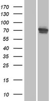 Western blot validation of overexpression lysate (Cat# LY410425) using anti-DDK antibody (Cat# TA50011-100). Left: Cell lysates from un-transfected HEK293T cells; Right: Cell lysates from HEK293T cells transfected with RC206394 using transfection reagent MegaTran 2.0 (Cat# TT210002).