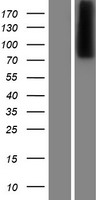 Western blot validation of overexpression lysate (Cat# LY412734) using anti-DDK antibody (Cat# TA50011-100). Left: Cell lysates from un-transfected HEK293T cells; Right: Cell lysates from HEK293T cells transfected with RC209394 using transfection reagent MegaTran 2.0 (Cat# TT210002).