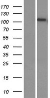 Western blot validation of overexpression lysate (Cat# LY414849) using anti-DDK antibody (Cat# TA50011-100). Left: Cell lysates from un-transfected HEK293T cells; Right: Cell lysates from HEK293T cells transfected with RC207231 using transfection reagent MegaTran 2.0 (Cat# TT210002).