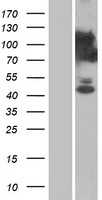 Western blot validation of overexpression lysate (Cat# LY414510) using anti-DDK antibody (Cat# TA50011-100). Left: Cell lysates from un-transfected HEK293T cells; Right: Cell lysates from HEK293T cells transfected with RC202301 using transfection reagent MegaTran 2.0 (Cat# TT210002).