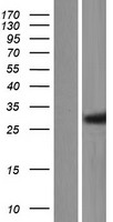 Western blot validation of overexpression lysate (Cat# LY407493) using anti-DDK antibody (Cat# TA50011-100). Left: Cell lysates from un-transfected HEK293T cells; Right: Cell lysates from HEK293T cells transfected with RC207934 using transfection reagent MegaTran 2.0 (Cat# TT210002).