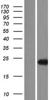 Western blot validation of overexpression lysate (Cat# LY426751) using anti-DDK antibody (Cat# TA50011-100). Left: Cell lysates from un-transfected HEK293T cells; Right: Cell lysates from HEK293T cells transfected with RC225237 using transfection reagent MegaTran 2.0 (Cat# TT210002).