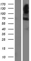 Western blot validation of overexpression lysate (Cat# LY404877) using anti-DDK antibody (Cat# TA50011-100). Left: Cell lysates from un-transfected HEK293T cells; Right: Cell lysates from HEK293T cells transfected with RC206097 using transfection reagent MegaTran 2.0 (Cat# TT210002).