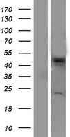 Western blot validation of overexpression lysate (Cat# LY415707) using anti-DDK antibody (Cat# TA50011-100). Left: Cell lysates from un-transfected HEK293T cells; Right: Cell lysates from HEK293T cells transfected with RC208099 using transfection reagent MegaTran 2.0 (Cat# TT210002).