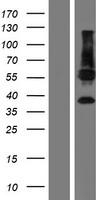 Western blot validation of overexpression lysate (Cat# LY406454) using anti-DDK antibody (Cat# TA50011-100). Left: Cell lysates from un-transfected HEK293T cells; Right: Cell lysates from HEK293T cells transfected with RC206672 using transfection reagent MegaTran 2.0 (Cat# TT210002).