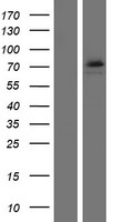 Western blot validation of overexpression lysate (Cat# LY405413) using anti-DDK antibody (Cat# TA50011-100). Left: Cell lysates from un-transfected HEK293T cells; Right: Cell lysates from HEK293T cells transfected with RC209870 using transfection reagent MegaTran 2.0 (Cat# TT210002).