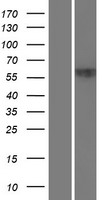 Western blot validation of overexpression lysate (Cat# LY412063) using anti-DDK antibody (Cat# TA50011-100). Left: Cell lysates from un-transfected HEK293T cells; Right: Cell lysates from HEK293T cells transfected with RC204831 using transfection reagent MegaTran 2.0 (Cat# TT210002).